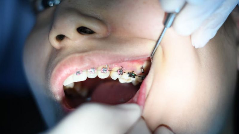 Dentiste Poitiers